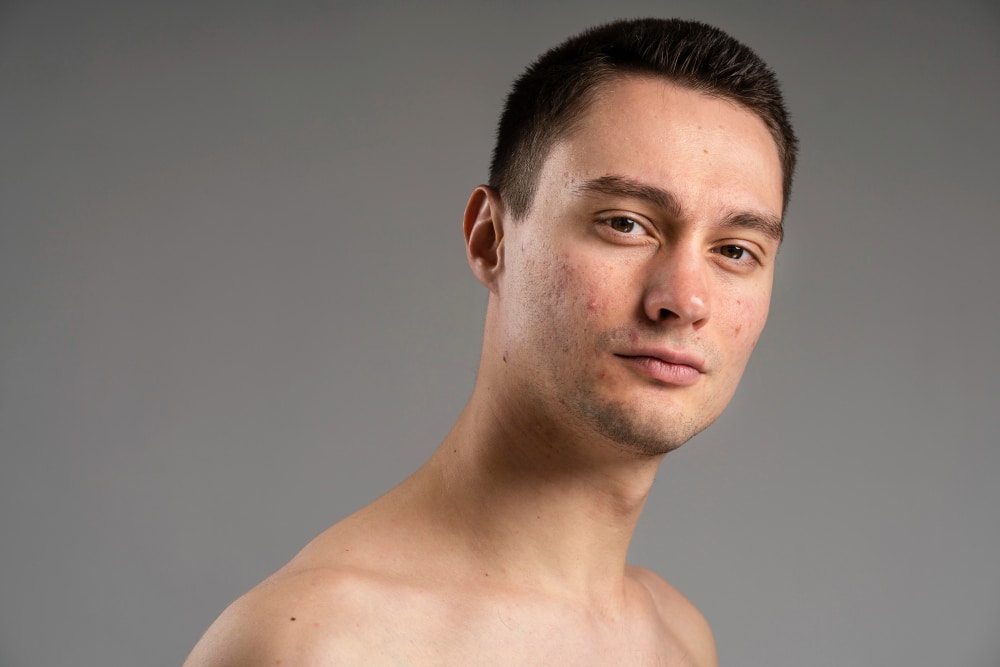How Does a BBL Photofacial Work?
